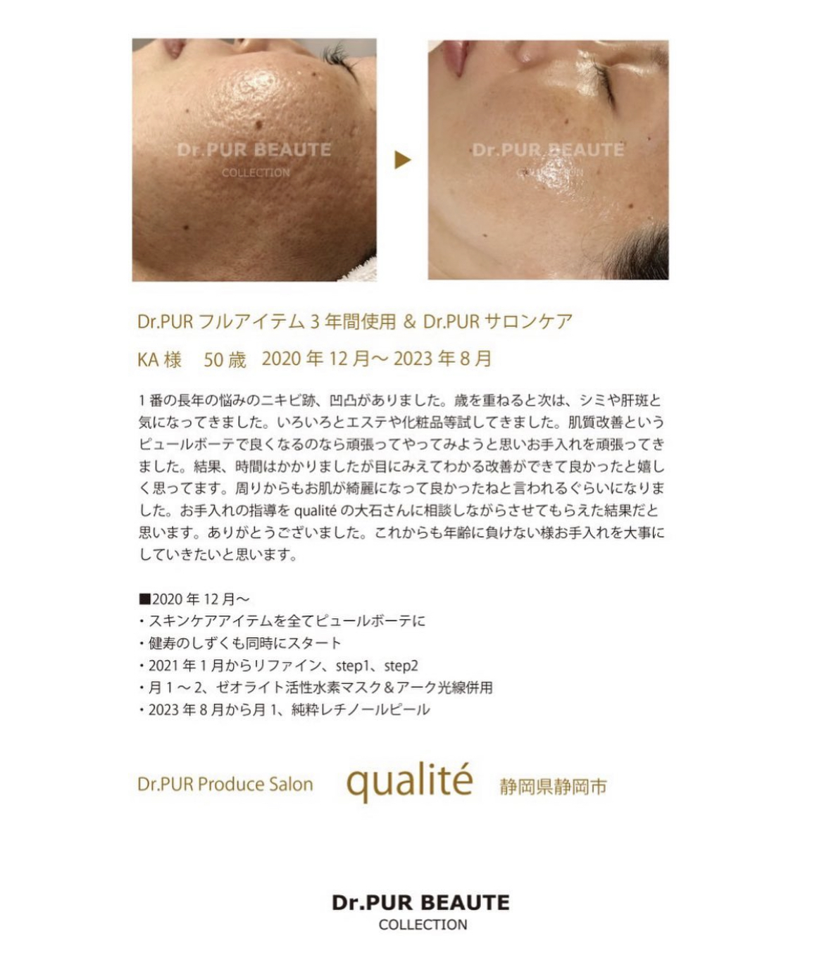 Best of Before After 2023 エントリー -  焼津のエステサロン、フェイシャル・コルギ小顔矯正ならFacial＆Bridalsalon.qualite